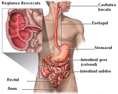 bolile intestinului